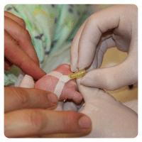 Baby Cannula Fixation