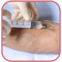 Intravenous  Injection with Butterfly needle