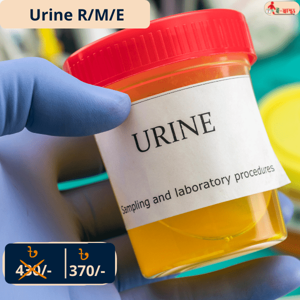 Urine R/M/E