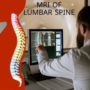 MRI of Lumbar Spine without Contrast